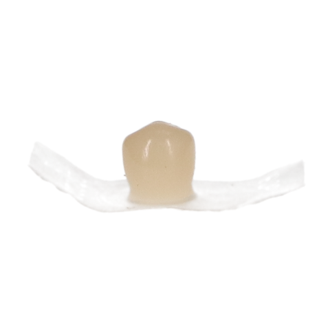 Protemp Crown Temporization Material, Adult, Refill, Lower Bicuspid, Universal Shade, 5/Pk Exp (01/20/2026)